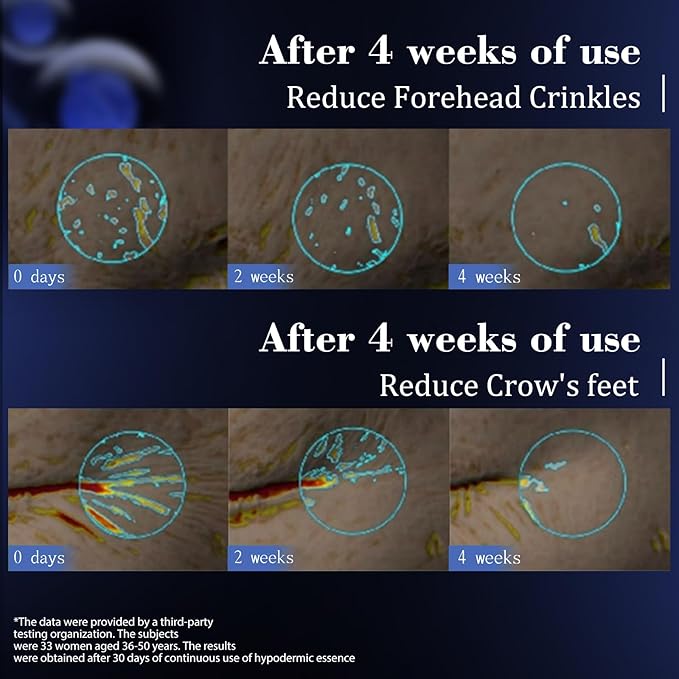 KISSIO Super Peptid Serum Ampoule,Face Serum with Copper Tripeptides,Collagen and Peptides,Hydration and Elasticity,Rejuvenating Facial Serum for Fine Lines and Wrinkles,Makeup Base,30 Ampoule